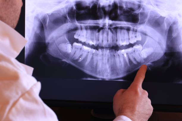 Best Broken or Cracked Tooth Emergency Dentist in New Johnsonville, TN