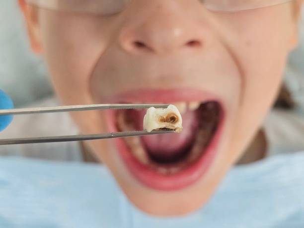 Best Urgent Dental Care for Toothache in New Johnsonville, TN